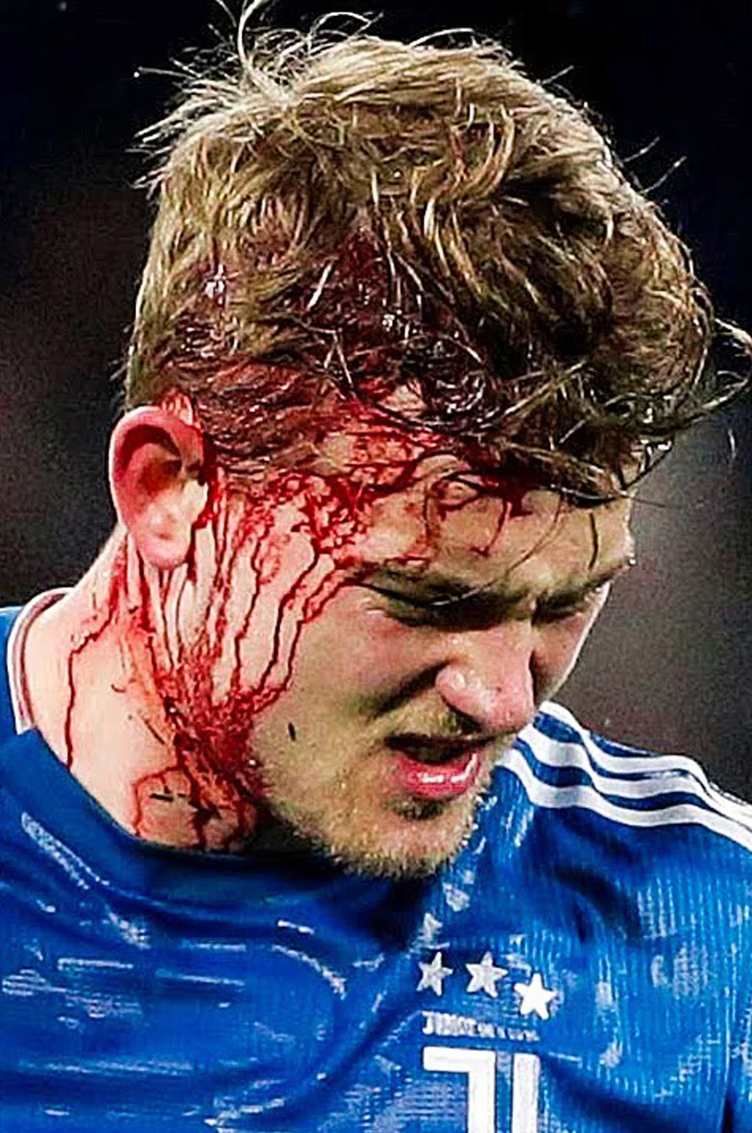 فیلم ترسناک ترین لحظات در فوتبال-horror moments in football